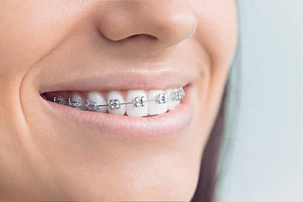 Best Dental Inlays and Onlays  in Prces Lakes, IN
